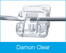 damon clear braces