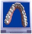 invisalign san jose