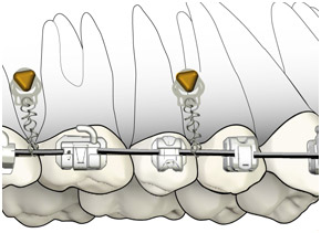 VectorTas System